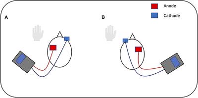 Transcranial Direct-Current Stimulation May Improve Discourse Production in Healthy Older Adults